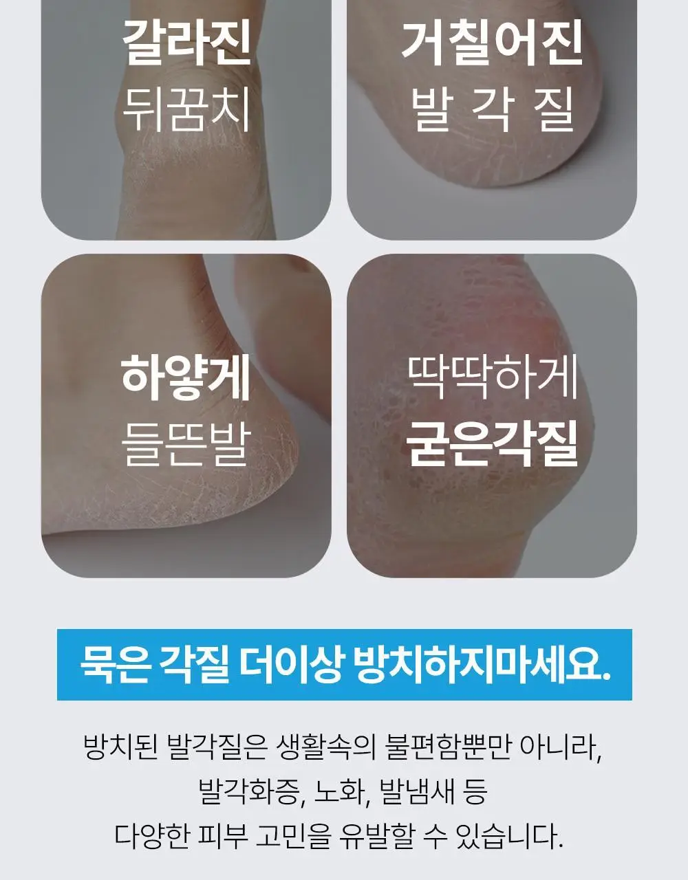 [2중 안전날]플루 퍼펙트 발 각질 면도기 상세페이지 4